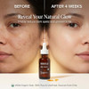 Offernova Organic Rosa Mosqueta Oil Rosehip Seed Oil Coldpressed 1 Oz