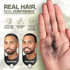 Hair Fibers For Thinning Hair 1.05 Oz Real Human Hair Building Fibers To Conceal Bald Spots And Thinning Hair Root Touch Up And Volumizer
