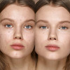 Kiko Milano Full Coverage Concealer 01 Light