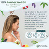 Zatural Rosa Canina Organic Rosehip Oil For Face Nails Hair And Skin Cold Pressed Rose Hip Oil 16 Oz