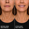 Contours Rx Neck Lift Tape Invisible Neck And Décolleté Strips 30 Ct