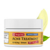 De La Cruz 10 Percent Sulfur Ointment Travel Size Cystic Acne Treatment For Face And Body Daily 10 Min Spot Treatment Mask Safe And