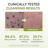 Yadah Green Tea Cleansing Balm 3.38 Fl Oz Makeup Remover