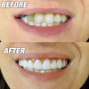 Instant Smile Flexible Lower Veneer Removable Cosmetic Teeth Cover