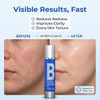 Perfect B3 Niacinamide Spray For Face Vitamin B3 Face Mist 3.6Oz