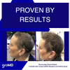 Gromd Biotin Shampoo And Conditioner Hair Growth Shampoo Hair Loss Shampoo For Men And Women Regrowth Treatment And Thickening Contains