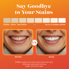Zimba Teeth Whitening Strips Vegan Whitening Strip Enamel Safe Teeth Whitening Hydrogen Peroxide Teeth Whitener For Coffee Wine Tobacco And