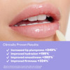 Kosas Wet Lip Oil Gloss Hydrating Lip Plumping Treatment With Hyaluronic Acid And Peptides Non Sticky Finish Jellyfish