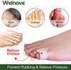 Welnove Gel Toe Separator Pinky Toe Spacers Little Toe Cushions For Preventing Rubbing And Relieve Pressure Pack Of 12