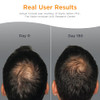 Viviscal Men S Hair Growth Supplements For Thicker Fuller Hair Clinically Proven Collagen Complex 60 Tablets 1 Month Supply