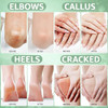 Urea Labs 42 Percent Urea Cream Max With Tea Tree Oil Urea Cream For Feet 4 Oz