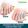 Povihome 10 Pack Pinky Toe Separator And Protectors For Overlapping Toe Curled Pinky Toes Spacers For Morton S Neuroma Pain Relief