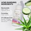 Pacifica Acne Spot Treatment And Pimple Cream Dry It Out Gel With 2 Percent Salicylic Acid Witch Hazel Niacinamide Dries Blemishes Overnight