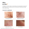 Minimalist 5 Percent Niacinamide Face Serum With Hyaluronic Acid For Clear Skin Reduces Blemishes Acne Marks Pore Minimizer Repairs And