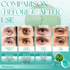 Mashele Korean 60Pcs Aloe Vera Collagen Under Eye Gel Patches Mask Treatment For Puffy Eyes Dark Circles Anti Wrinkle Pads Moisturizing For