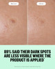 Peace Out Microneedling Dots For Dark Spots 12 Count