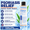 Dermasolve Scalp Psoriasis And Dandruff Free Medicated Shampoo With Conditioner Ultimate Seborrheic Dermatitis Treatment For Itchy Flakey