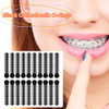 1040 Pcs Black Braces Rubber Bands Orthodontic Ligature Ties O Rings Elastic Bands For Braces Black