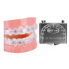Obrush Comfort Covers For Braces Orthodontic Mouth Guard Lip Protector Wax Alternative Lip Shield For Brackets