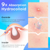Avapy Pimple Patches For Face Cute Hydrocolloid Acne Patches Colorful Hologram Star Sport Stickers Zits And Blemish Pimple Patch With
