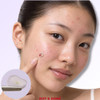 Dot And Done Hydrocolloid Pimple Patches For Face 48 Count 12 Mm Round Acne Spot Dots Cute Dog Designs Cute Pimple Patch For Teen Girls