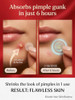 Jasmia Clear Patch Pimple Patches Invisible Hydrocolloid Spot Dots For Face Drug Free Dermatologist Tested 72 Count