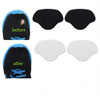 Sneaker Toe Heel Prevention Repair Shoe Hole Toeburst Patch Insert Wear Self Adhesive 1Pairs Of Black And 1 Pair Of White