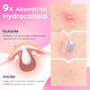 Avapy Pimple Patches For Face Cute Hydrocolloid Acne Patches Colorful Hologram Flower Sport Stickers Zits And Blemish Pimple Patch With