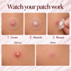 Zing Skincare Prime Patch Clear Hydrocolloid Pimple Patches For Face 45Pc