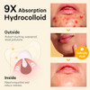 Sosky Chin Pimple Patches Hydrocolloid Acne Patches For Breakouts Large Spot Control Covers For Face Chin And Body Vegan Cruelty Free 10