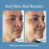 Otella Detox And Soothe Face Mist With Hypochlorous Acid .02 Percent 2.7 Oz Helps Reduce Redness Irritation Breakouts Rosacea Eczema