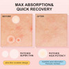Avjone Pimple Patches For Face 144 Patches Hydrocolloid Acne Patches With Tea Tree Oil Pimple Stickers For Breakouts Absorbs Zit Invisible