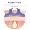 Hydrocolloid Pimple Patch Star Heart Acne Patches 3 Sizes 40 Counts Spot Blemish Stickers Zit Dot Colorful Cover Breakout Hiding Face