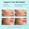 Maree Azelaic Acid 15 Percent Face Cream Azelaic Acid Serum Cream For Dark Spots