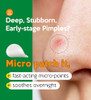 Troubless Invisible Pimple Spot Patch Classic Hydrocolloid Acne Patches For Face Ultra Thin Acne Patches With Easy Peel Handle Overnight