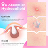 Avapy Pimple Patches For Face Cute Hydrocolloid Acne Patches Colorful Hologram Star Sport Stickers Zits And Blemish Pimple Patch With