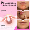 Avapy Hydrocolloid Chin Acne Patches Xl Extra Large Pimple Patches For Face Chin And Body Breakouts Tea Tree And Calendula Oil For Blemish