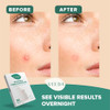 Veeda Glow Pimple Patches Hydrocolloid Acne Patches For Face Absorb Pus And Flatten Blemishes Overnight Invisible Zit Spot Treatment Non