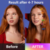 Jo Dominic Pimple Patches For Face 224 Count Hydrocolloid Acne Patches Cute Colorful Star Blemish Patches With Salicylic Acid Tea Tree Oil