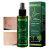 Mokyduo Acne Treatment Spray With Tea Tree Oil Body And Face 4.3 Oz