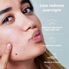 Omma Microdart Cystic Acne Patches Pimple Patches For Face 18 Ct