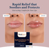Medibalm For Dry Cracked Lips Healing Lip Balm For Severely Chapped Lips Designed For Men Women And Children By Pharmacists 1 White
