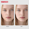 Aiyuanqi Large Pimple Patches For Facial Use 180 Pieces In Two Sizes Acne Hydrocolloid Patches With Salicylic Acid And Tea Tree Extract Fast