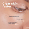 Vitamedica Clear Skin Spot Dots Hydrocolloid Acne Patches 144 Count