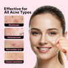 Charmcherry Pimple Patches For Face 18 Count Microdart Acne Patches Hydrocolloid Blemish Spot With Salicylic Acid Fast Acting For Early