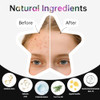 Redanha 240 Count Star Pimple Patches For Face Hydrocolloid Acne Pimple Patch With Tea Tree Oil For Party Gift Covering Zits Blemishes