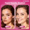 Jo Dominic Star Pimple Patches For Face 4 Sizes 160 Counts Acne Patches Hydrocolloid Material Cute And Shining Pimple Patches For Covering