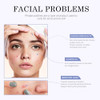 Josurbeauty Invisible Pimple Patches For Face Acne Patches Zit Patches Cute Star Covers 3 Sizes 8Mm 10Mm And 12Mm 200 Count