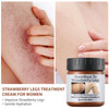 Strawberry Legs Treatment Cream For Women Keratosis Pilaris Lotion Chicken Skin Treatment Moisturizing Strawberry Skin Smooth Radiant Skin Care Solut