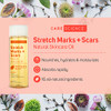 Care Science Natural Skin Care Body Oil Serum For Scars and Stretch Marks | Face and Body Moisturizer | Hair, Anti Aging, Dehydrated Skin, C Section